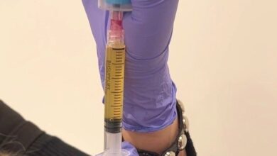 Skin rejuvenation Chicago