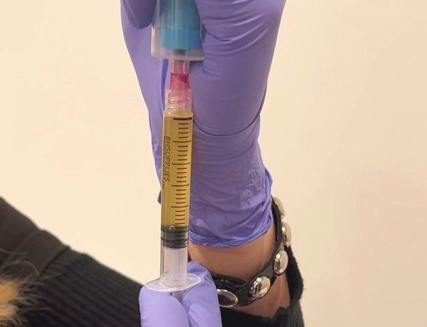 Skin rejuvenation Chicago