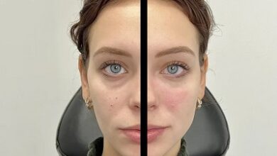 Skin Rejuvenation Chicago