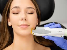 Best Laser Treatments in Chicago