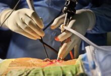 Best Spine Surgery Hospital in Kerala