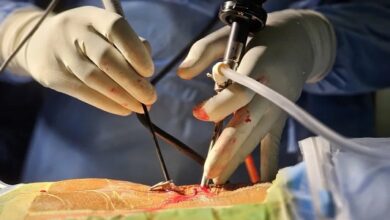 Best Spine Surgery Hospital in Kerala