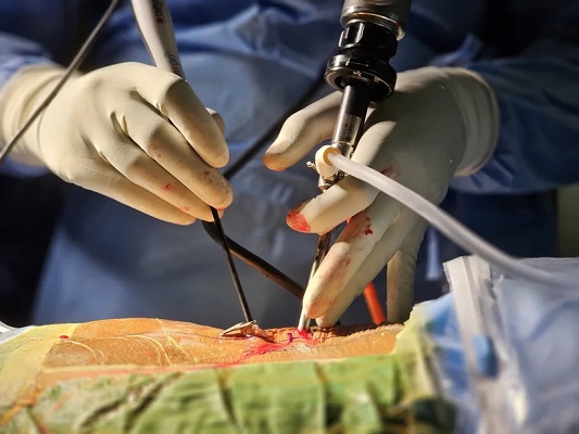 Best Spine Surgery Hospital in Kerala