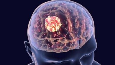 Best Brain Tumor Treatment in India